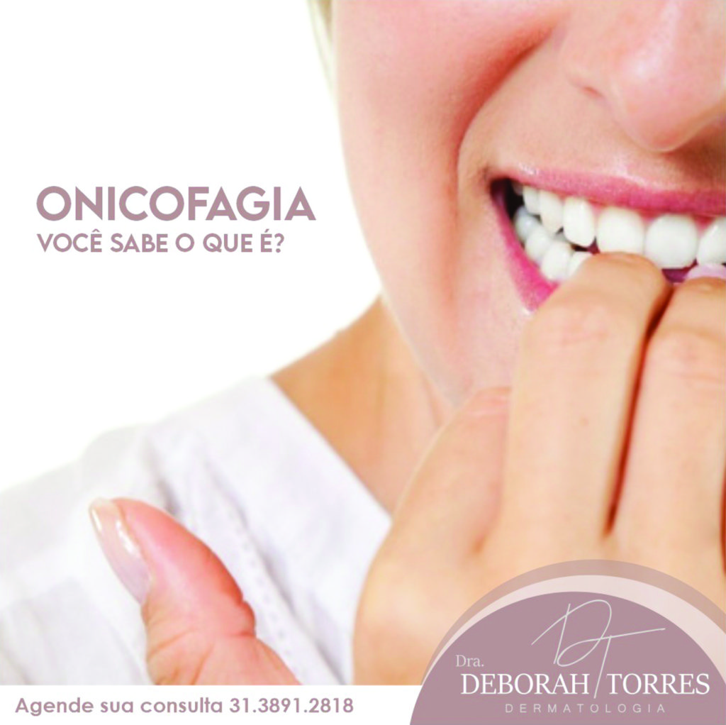 Você sabe o que é Onicofagia! - Líder Notícias | A informação na medida ...